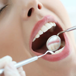 Woman getting a dental exam